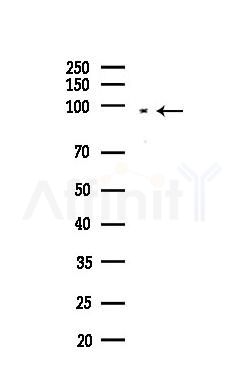 HMGCR Recombinant Rabbit mAb - Western blot analysis of lysates from EC304 cells(heat-shock,45min treatment), using HMGCR Recombinant Rabbit mAb at 1/1000 dilution.