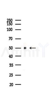 DFNA5/GSDME Recombinant Rabbit mAb - Western blot analysis of lysates from Hela cells(LPS,4h treatment), using DFNA5/GSDME Recombinant Rabbit mAb at 1/1000 dilution.