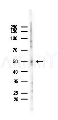 DFNA5/GSDME Recombinant Rabbit mAb - Western blot analysis of lysates from Rat testis, using DFNA5/GSDME Recombinant Rabbit mAb at 1/1000 dilution.