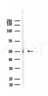 DFNA5/GSDME Recombinant Rabbit mAb - Western blot analysis of lysates from 293 cells(heat-shock,45min treatment), using DFNA5/GSDME Recombinant Rabbit mAb at 1/1000 dilution.