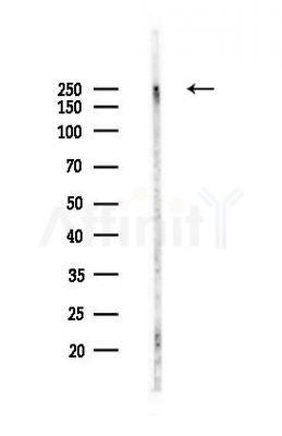 NG2 Recombinant Rabbit mAb - Western blot analysis of lysates from Mouse liver, using CSPG4 Recombinant Rabbit mAb at 1/1000 dilution.