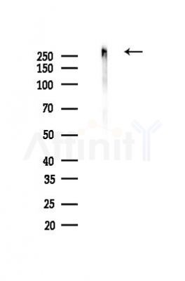 NG2 Recombinant Rabbit mAb - Western blot analysis of lysates from Rat heart, using NG2 Recombinant Rabbit mAb at 1/1000 dilution.