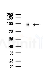 PSD95 Recombinant Rabbit mAb - Western blot analysis of lysates from Mouse brain, using PSD95 Recombinant Rabbit mAb at 1/1000 dilution.