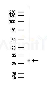 XBP1 Recombinant Rabbit mAb - Western blot analysis of lysates from LoVo cells(heat-shock,45min treatment), using XBP1 Recombinant Rabbit mAb at 1/1000 dilution.
