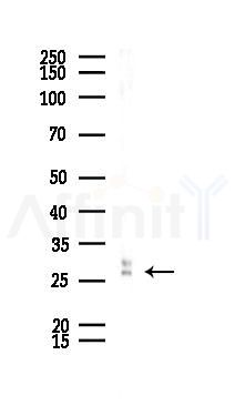 NGF Recombinant Rabbit mAb - Western blot analysis of lysates from LoVo cells(heat-shock,45min treatment), using NGF Recombinant Rabbit mAb at 1/1000 dilution.