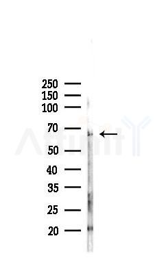 ABCG2 Recombinant Rabbit mAb - Western blot analysis of lysates from PC12 cells(LPS,4h treatment), using BCRP/ABCG2 Recombinant Rabbit mAb at 1/1000 dilution.