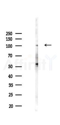 OPA1 Recombinant Rabbit mAb - Western blot analysis of lysates from PC12 cells(LPS 4h treatment), using OPA1 Recombinant Rabbit mAb at 1/1000 dilution.