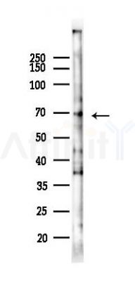 NOX4 Recombinant Rabbit mAb - Western blot analysis of lysates from Rat testis, using NADPH oxidase 4 Rabbit mAb at 1/1000 dilution.