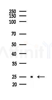 SOD2/MnSOD Recombinant Rabbit mAb - Western blot analysis of lysates from COLO205 cells(heat-shock, 45min treatment), using SOD2 Recombinant Rabbit mAb at 1/1000 dilution.