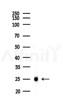 SOD2/MnSOD Recombinant Rabbit mAb - Western blot analysis of lysates from Mouse liver, using SOD2 Recombinant Rabbit mAb at 1/1000 dilution.