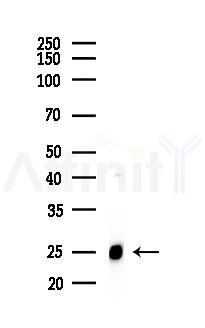 SOD2/MnSOD Recombinant Rabbit mAb - Western blot analysis of lysates from Rat brain, using SOD2 Recombinant Rabbit mAb at 1/1000 dilution.