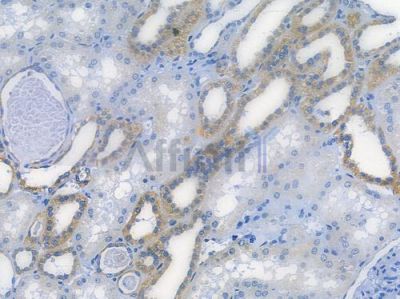 SOD2/MnSOD Recombinant Rabbit mAb - BF3212 at 1/100 staining human normal kidney tissue by IHC-P.