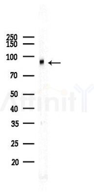 Phospho-Trk B (Tyr705) Recombinant Rabbit mAb - Western blot analysis of lysates from A2780 cells(LPS 4h treatment), using Phospho-TrkB (Tyr705) Recombinant Rabbit mAb at 1/1000 dilution.