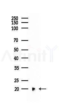 Phospho-4E-BP1 (Thr45) Recombinant Rabbit mAb - Western blot analysis of lysates from B16F10-LUC cells(LPS, 4h treatment), using Phospho-eIF4EBP1/eIF4EBP2/eIF4EBP3 (Thr45) Recombinant Rabbit mAb at 1/1000 dilution.