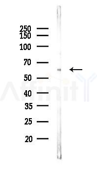 PTEN Recombinant Rabbit mAb - Western blot analysis of lysates from LoVo cells(heat-shock,45min treatment), using PTEN Recombinant Rabbit mAb at 1/1000 dilution.