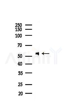 CALR Recombinant Rabbit mAb - Western blot analysis of lysates from Mouse liver, using Calreticulin Recombinant Rabbit mAb at 1/1000 dilution.
