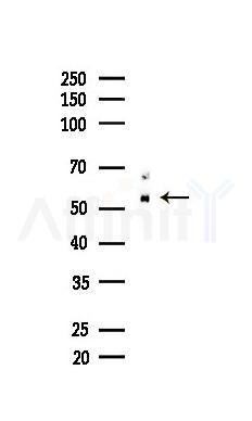 CALR Recombinant Rabbit mAb - Western blot analysis of lysates from HUVEC cells(LPS,4h treatment), using Calreticulin Recombinant Rabbit mAb at 1/1000 dilution.