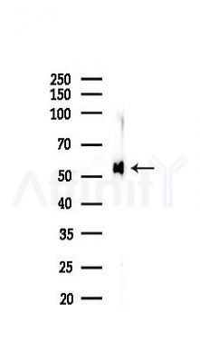 CALR Recombinant Rabbit mAb - Western blot analysis of lysates from Rat lung, using Calreticulin Recombinant Rabbit mAb at 1/1000 dilution.