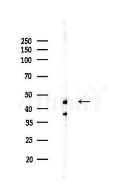 Caspase 4 Recombinant Rabbit mAb - Western blot analysis of lysates from Hela cells(LPS,4h treatment), using Caspase-4 Recombinant Rabbit mAb at 1/1000 dilution.
