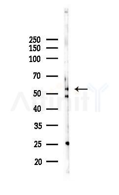 IRF7 Recombinant Rabbit mAb - Western blot analysis of lysates from Rat lung, using IRF7 Recombinant Rabbit mAb at 1/1000 dilution.