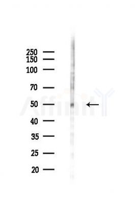 Phospho-p53 (Ser392) Recombinant Rabbit mAb - Western blot analysis of lysates from EC304 cells(LPS,4h treatment), using Phospho-p53 (Ser392) Rabbit mAb at 1/1000 dilution.