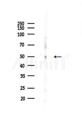 Phospho-p53 (Ser392) Recombinant Rabbit mAb - Western blot analysis of lysates from A375 cells(heat-shock,45min treatment), using Phospho-p53 (Ser392) Rabbit mAb at 1/1000 dilution.