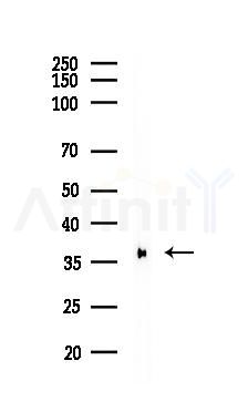 Phospho-eIF2 alpha (Ser51) Recombinant Rabbit mAb - Western blot analysis of lysates from A375 cells(heat-shock,45min treatment), using Phospho-EIF2S1 (Ser51) Recombinant Rabbit mAb at 1/1000 dilution.