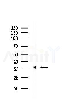 Phospho-eIF2 alpha (Ser51) Recombinant Rabbit mAb - Western blot analysis of lysates from COLO205 cells(LPS, 4h treatment), using Phospho-EIF2S1 (Ser51) Recombinant Rabbit mAb at 1/1000 dilution.