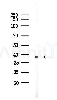 eIF2 alpha Recombinant Rabbit mAb - Western blot analysis of lysates from LoVo cells(heat-shock,45min treatment), using EIF2S1 Recombinant Rabbit mAb at 1/1000 dilution.