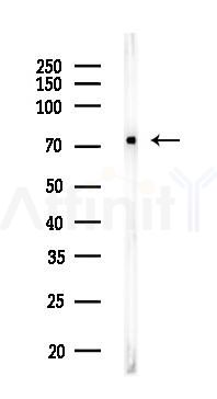 GRP78 Recombinant Rabbit mAb - Western blot analysis of lysates from Hela cells(LPS,4h treatment), using GRP78 BiP Recombinant Rabbit mAb at 1/1000 dilution.