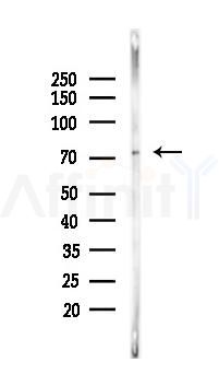 GRP78 Recombinant Rabbit mAb - Western blot analysis of lysates from HUVEC cells(LPS,4h treatment), using GRP78 BiP Recombinant Rabbit mAb at 1/1000 dilution.