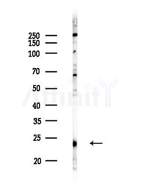 TIMP1 Recombinant Rabbit mAb - Western blot analysis of lysates from EC304 cells(LPS,4h treatment), using TIMP1 Rabbit mAb at 1/1000 dilution.