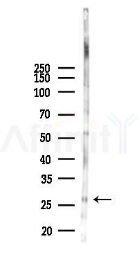 Neutrophil Elastase Recombinant Rabbit mAb - Western blot analysis of lysates from Mouse lung, using Neutrophil Elastase Recombinant Rabbit mAb at 1/1000 dilution.