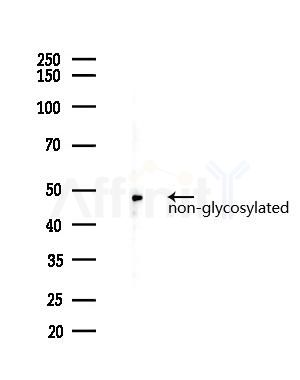 LAMP1 Recombinant Rabbit mAb - Western blot analysis of lysates from Hela cells(heat-shock 45min treatment), using LAMP1 Recombinant Rabbit mAb at 1/1000 dilution.