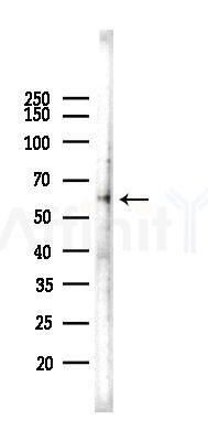 Phospho-Src (Tyr419) Recombinant Rabbit mAb - Western blot analysis of lysates from HepG2 cells(heat-shock,45min treatment), using Phospho-Src (Tyr419) Rabbit mAb at 1/1000 dilution.