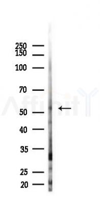Phospho-Src (Tyr418) Recombinant Rabbit mAb - Western blot analysis of lysates from 293 cells(heat-shock,45min treatment), using Phospho-SRC Family (Tyr418) Recombinant Rabbit mAb at 1/1000 dilution.