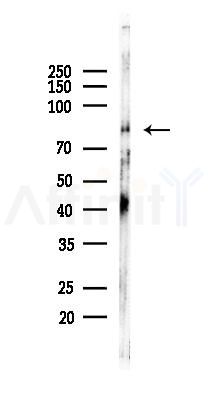 Mitofusin 2 Recombinant Rabbit mAb - Western blot analysis of lysates from B16F10-LUC cells(LPS, 4h treatment), using Mitofusin 2 Recombinant Rabbit mAb at 1/1000 dilution.