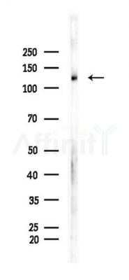 Notch 1 Recombinant Rabbit mAb - Western blot analysis of lysates from Rat brain, using Notch1 Recombinant Rabbit mAb at 1/1000 dilution.