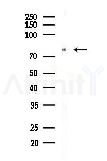 FOXO3A Recombinant Rabbit mAb - Western blot analysis of lysates from B16F10-LUC cells(LPS, 4h treatment), using FOXO3A Recombinant Rabbit mAb at 1/1000 dilution.