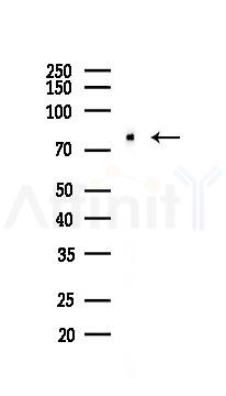 FOXO3A Recombinant Rabbit mAb - Western blot analysis of lysates from Rat brain, using FOXO3A Recombinant Rabbit mAb at 1/1000 dilution.
