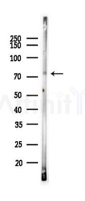 FOXO3A Recombinant Rabbit mAb - Western blot analysis of lysates from A2780 cells(LPS 4h treatment), using FOXO3A Recombinant Rabbit mAb at 1/1000 dilution.