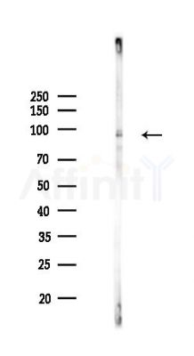 Phospho-FOXO3A (Ser253) Recombinant Rabbit mAb - Western blot analysis of lysates from COLO205 cells(LPS,4h treatment), using Phospho-FOXO3A (Ser253) Recombinant Rabbit mAb at 1/1000 dilution.