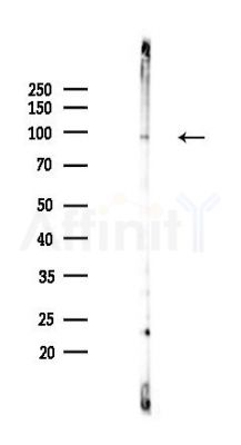 Phospho-FOXO3A (Ser253) Recombinant Rabbit mAb - Western blot analysis of lysates from HepG2 cells(heat-shock,45min treatment), using Phospho-FOXO3A (Ser253) Recombinant Rabbit mAb at 1/1000 dilution.