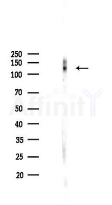 Integrin beta 1 Recombinant Rabbit mAb - Western blot analysis of lysates from COLO205 cells(LPS,4h treatment), using Integrin beta 1 Recombinant Rabbit mAb at 1/1000 dilution.