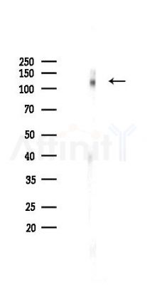 Integrin beta 1 Recombinant Rabbit mAb - Western blot analysis of lysates from HepG2 cells(heat-shock,45min treatment), using Integrin beta 1 Recombinant Rabbit mAb at 1/1000 dilution.