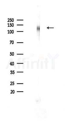 Integrin beta 1 Recombinant Rabbit mAb - Western blot analysis of lysates from Rat lung, using Integrin beta 1 Recombinant Rabbit mAb at 1/1000 dilution.