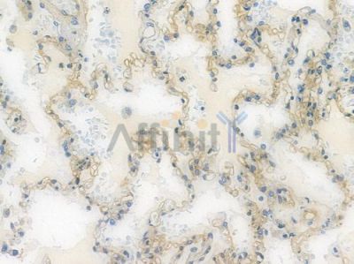 Integrin beta 1 Recombinant Rabbit mAb - BF3249 at 1/100 staining human normal lung tissue by IHC-P.