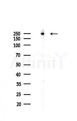 ACC1 Recombinant Rabbit mAb - Western blot analysis of lysates from A2780 cells(starvation 24h treatment), using Acetyl Coenzyme A carboxylase alpha Recombinant Rabbit mAb at 1/1000 dilution.