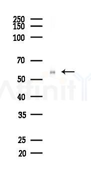 Phospho-Smad2 (Ser250) Recombinant Rabbit mAb - Western blot analysis of lysates from Rat brain, using Phospho-Smad2 (Ser250) Recombinant Rabbit mAb at 1/1000 dilution.