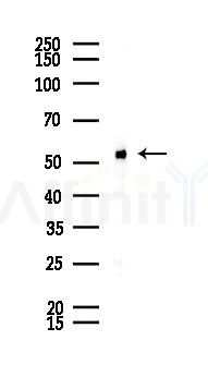 Phospho-Smad2 (Ser250) Recombinant Rabbit mAb - Western blot analysis of lysates from LoVo cells(heat-shock,45min treatment), using Phospho-Smad2 (Ser250) Recombinant Rabbit mAb at 1/1000 dilution.